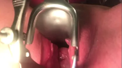 VLXX