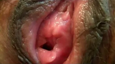 VLXX
