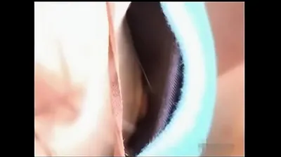 VLXX