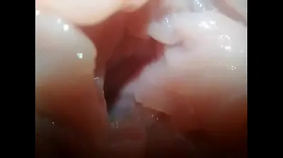 VLXX