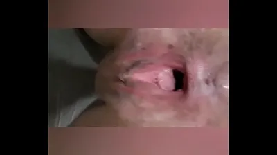VLXX