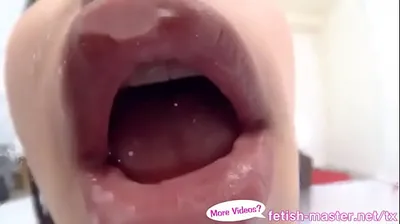 VLXX