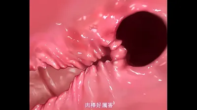 VLXX