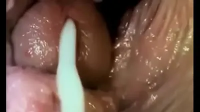 VLXX