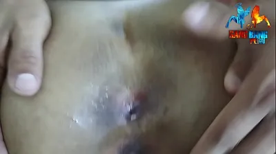 VLXX