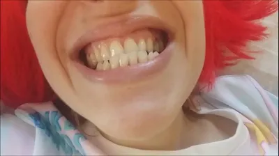 VLXX