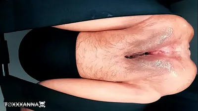 VLXX
