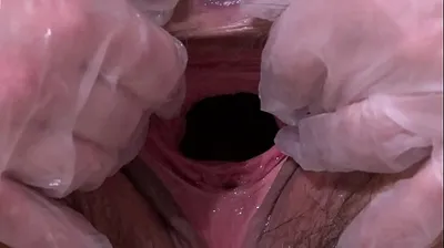VLXX