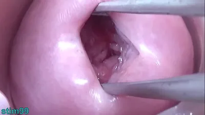 VLXX