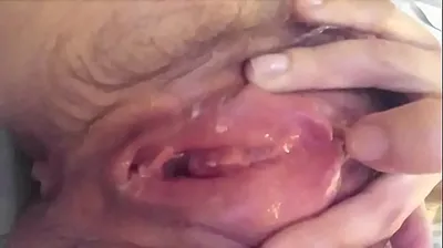 VLXX