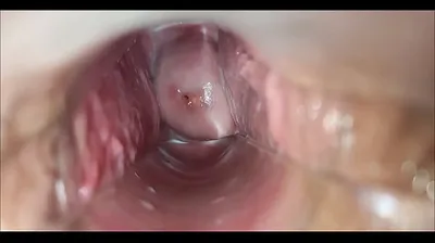 VLXX