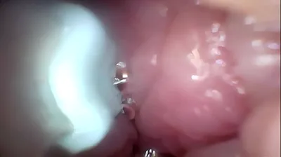 VLXX