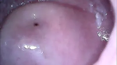VLXX