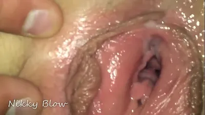 VLXX