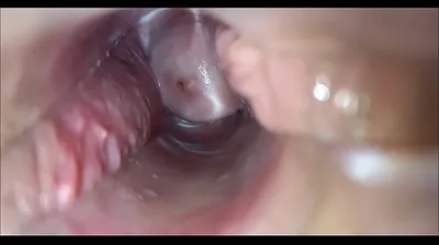 VLXX