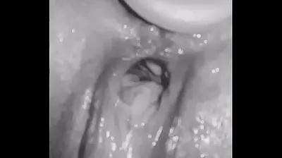 VLXX