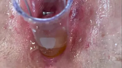 VLXX